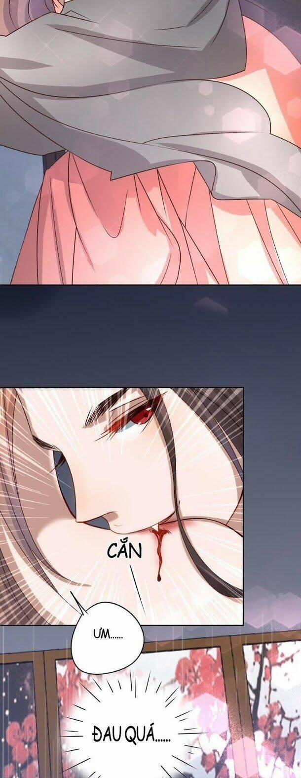 Hầu Gia Nhà Ta Không Sủng Ta 8 trang 5