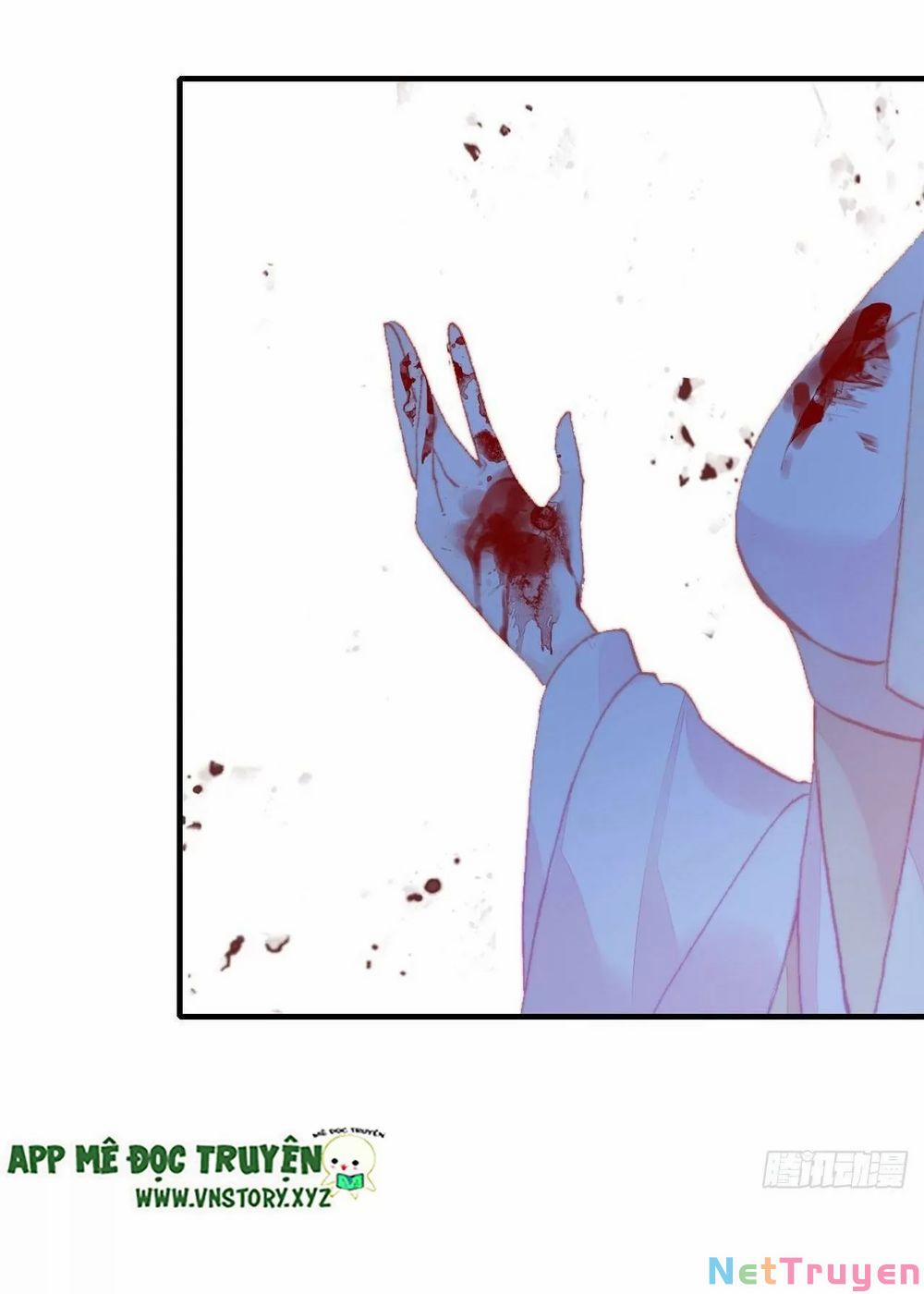 Lại Bị Bệnh Chiều Chuộng Quấn Lấy 0 Thần rơi xuống trang 14