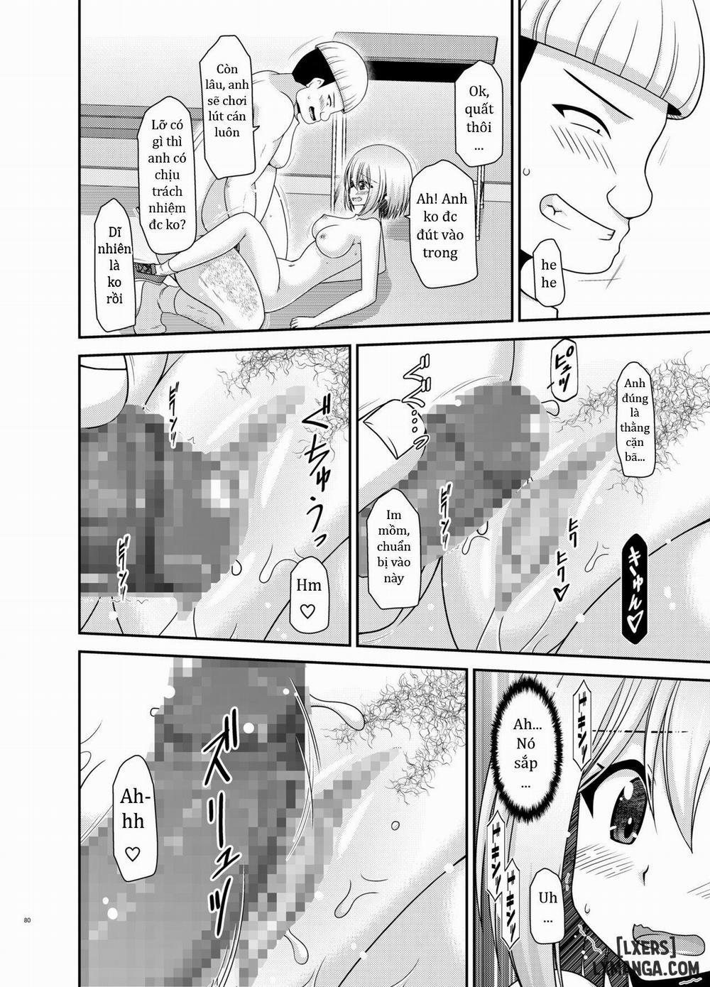 Nozokare Roshutsu Shoujo 2 trang 79