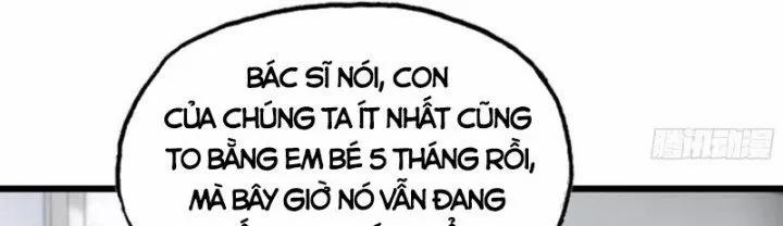 Tôi Chuyển Vàng Tại Mạt Thế 432 trang 152