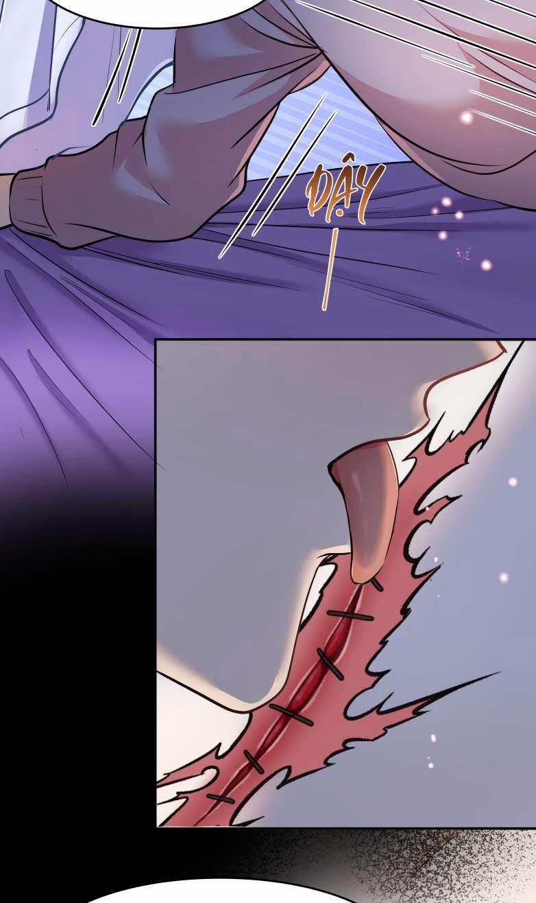 Trần Thương (Vết Sẹo Cũ) 89 trang 30